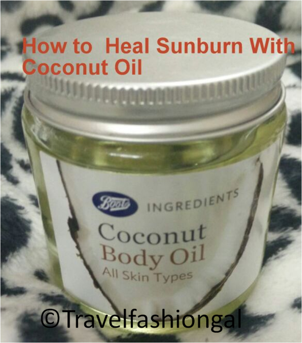 How to heal sunburn with coconut oil